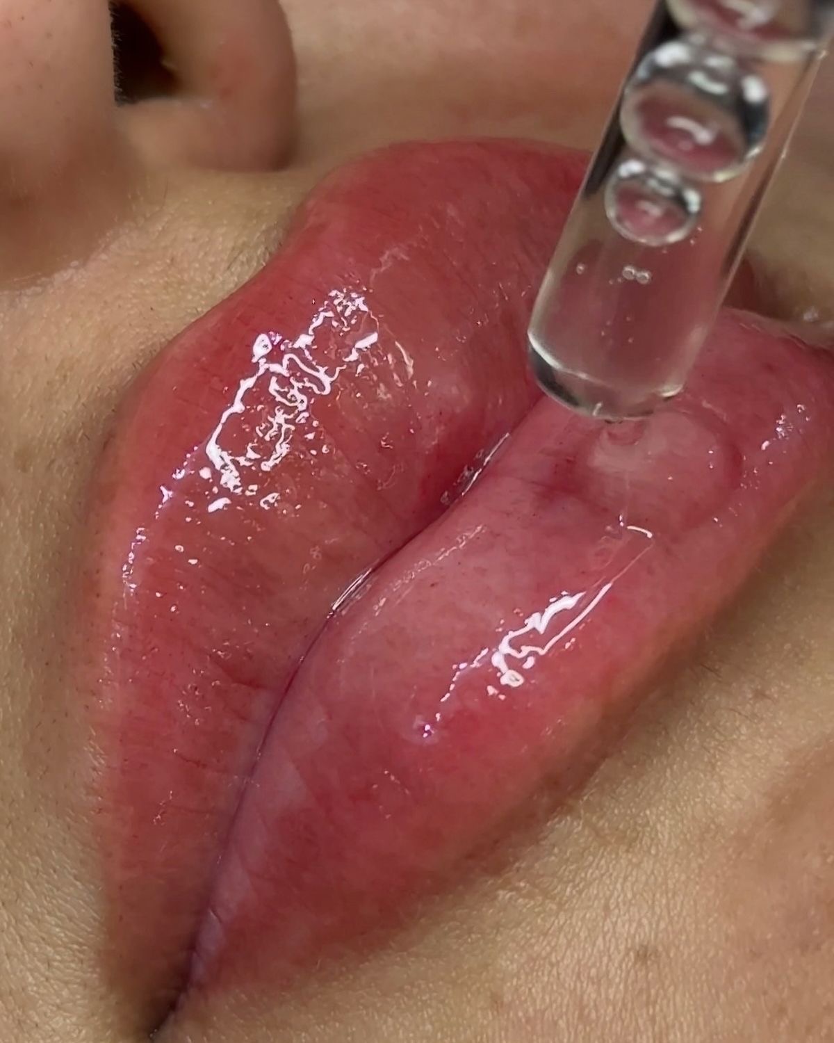 Lash lifting